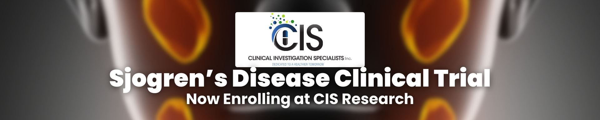 Sjogren's Disease clinical trial now enrolling at CIS research