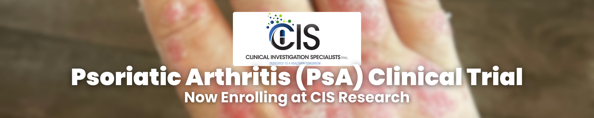 Psoriatic Arthritis Clinical Trial